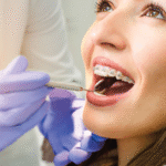Why Orthodontics Is a Growing Trend Among Adults