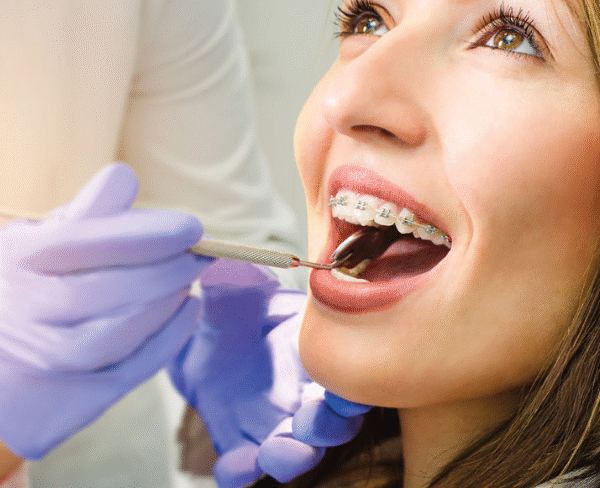 Why Orthodontics Is a Growing Trend Among Adults