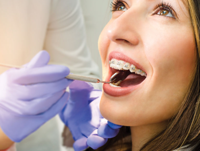 Why Orthodontics Is a Growing Trend Among Adults