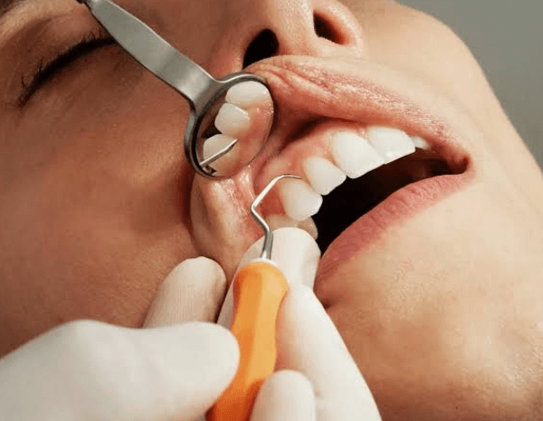 Why Preventive Dentistry Protects Both Health and Finances